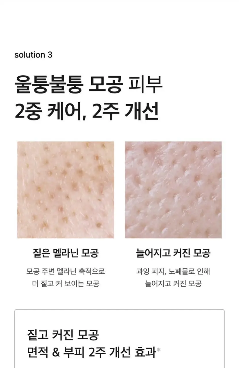 [기현PICK/대용량] 셀리맥스 브라이트닝 모공잡티패드 기획 (80매+20매) 상세페이지 28